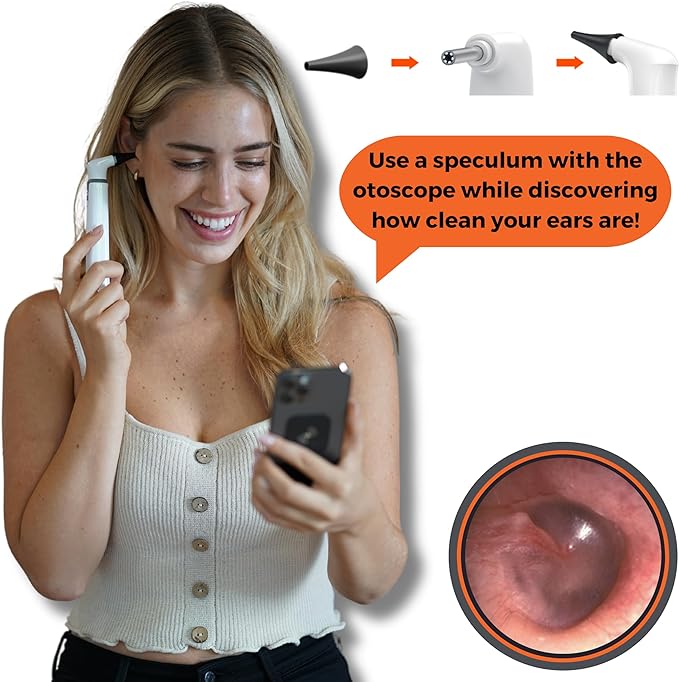 MOBI 10-Piece Speculum Set for Use with MOBI Smart Wi-Fi Otoscope (Item# 70676) - Image 4