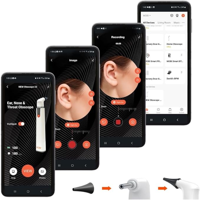 MOBI 10-Piece Speculum Set for Use with MOBI Smart Wi-Fi Otoscope (Item# 70676) - Image 7