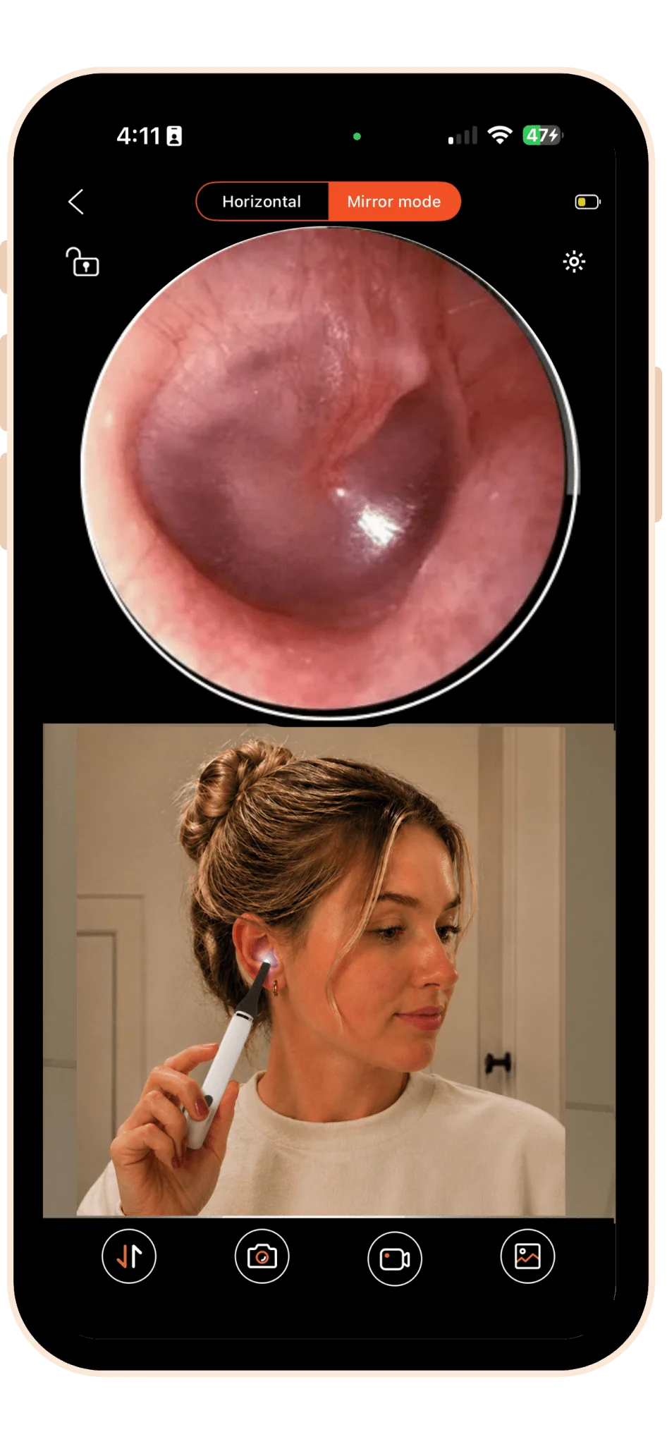 MOBI Smart Ear, Nose & Throat Camera - Image 3