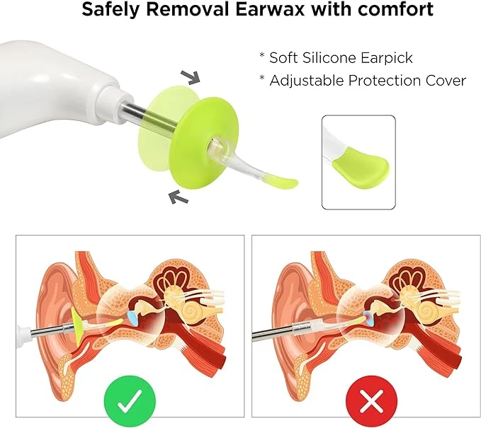 MOBI Smart Otoscope Ear Cleaning Accessory Kit for Wi‑Fi Otoscope - Image 3