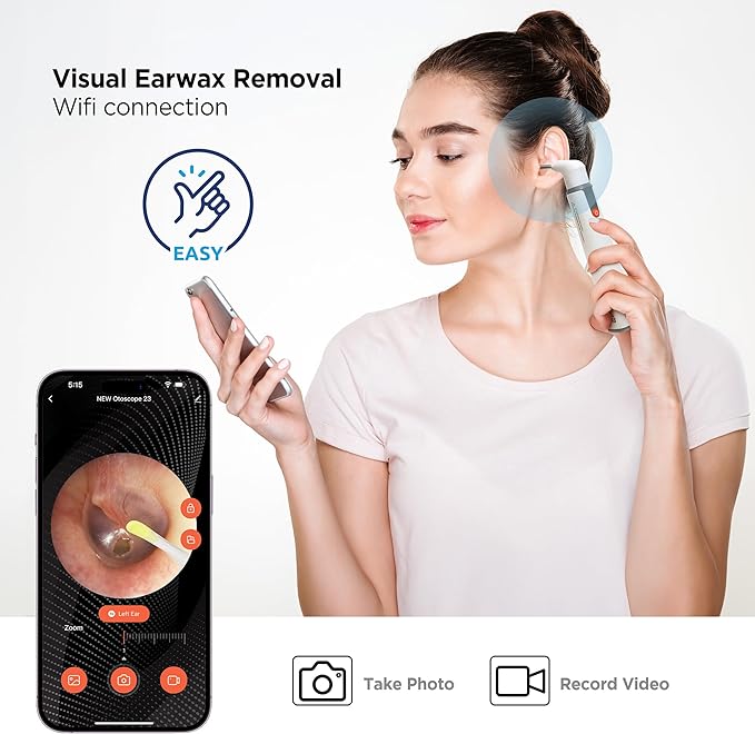 MOBI Smart Otoscope Ear Cleaning Accessory Kit for Wi‑Fi Otoscope - Image 4