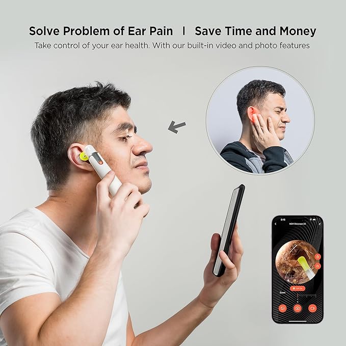 MOBI Smart Otoscope Ear Cleaning Accessory Kit for Wi‑Fi Otoscope - Image 5